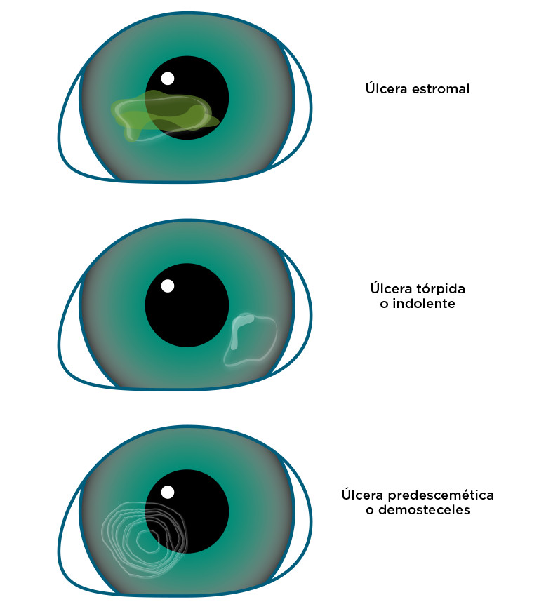 Úlcera Corneal En Gatos Tratamiento Duración Y Riesgos Veterinaria 9303